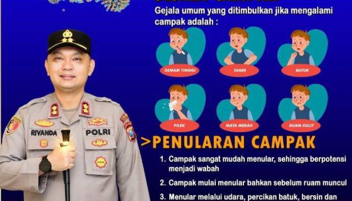 Polres Sumenep Ajak Masyarakat Waspada Campak, Kenali Gejala dan Lakukan Pencegahan